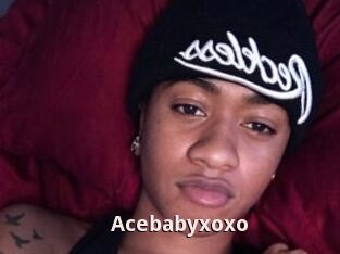 Acebabyxoxo